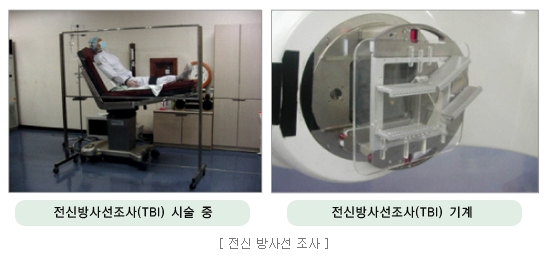 전신방사선조사.jpg