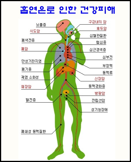 [폐암]폐암의 위험 요인들..