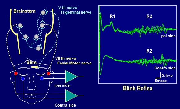 belk reflex