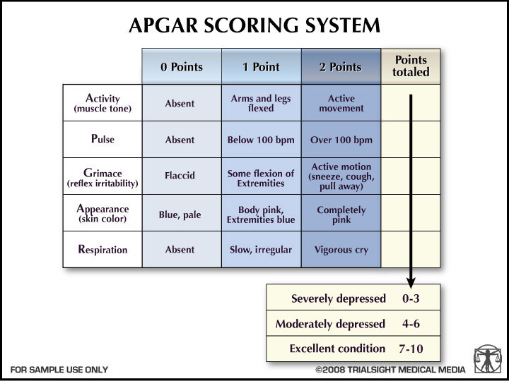 APGAR score (아프가 점수) : 네이버 블로그