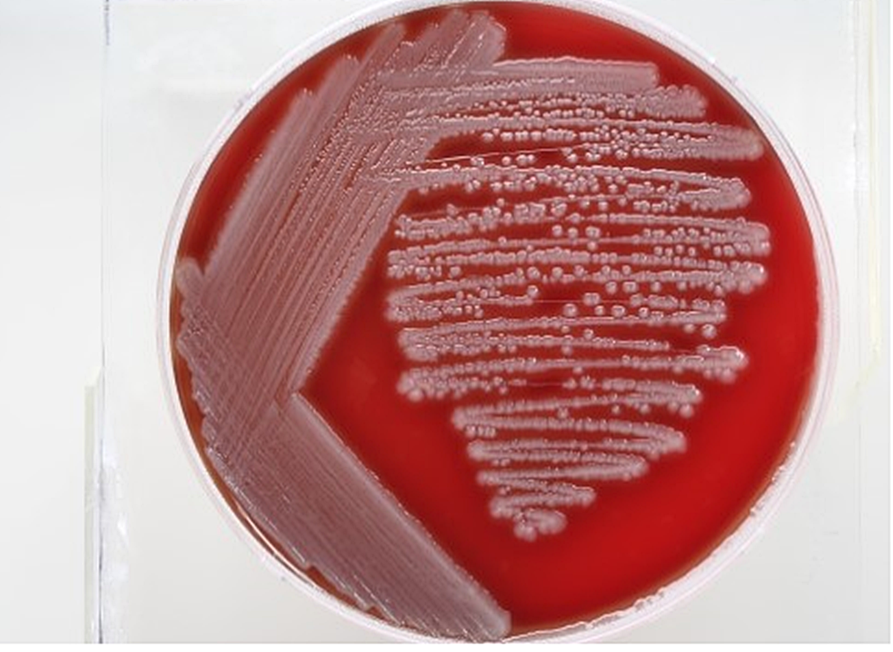 혈액배지 (blood agar)와 초콜렛배지 (chocolate agar) 네이버 블로그