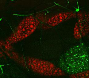 공초점 레이저 현미경 - 공초점 현미경 Leica TCS SP8 CARS - 블로그