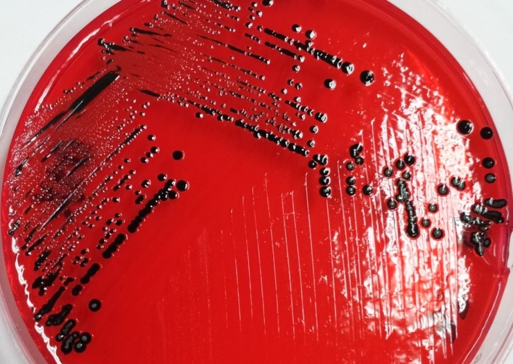 [살모넬라] XLD Agar배지, Salmonella spp. 네이버 블로그