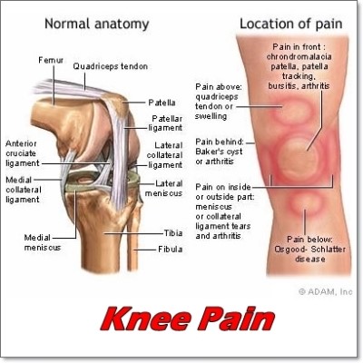 Knee_Pain.jpg