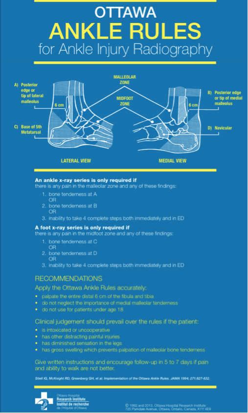 XRay 없이 발목골절 여부 검사하는 방법, 오타와 룰(Ottawa Rule) 네이버 블로그