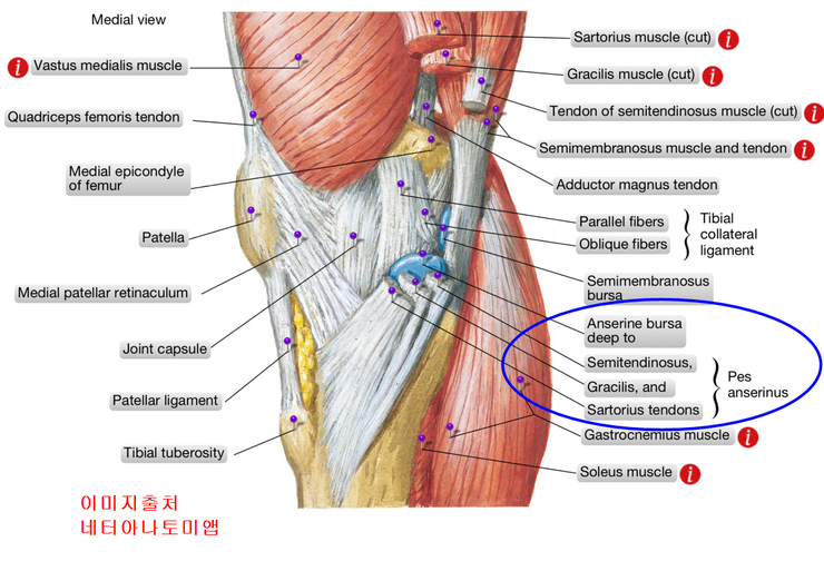 Pes Anserine Bursitis