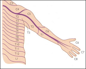 경추 척추증 - Cervical spondylosis : 네이버 블로그