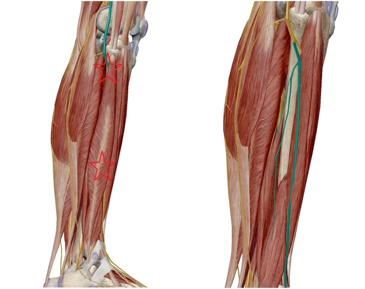 lateral-line