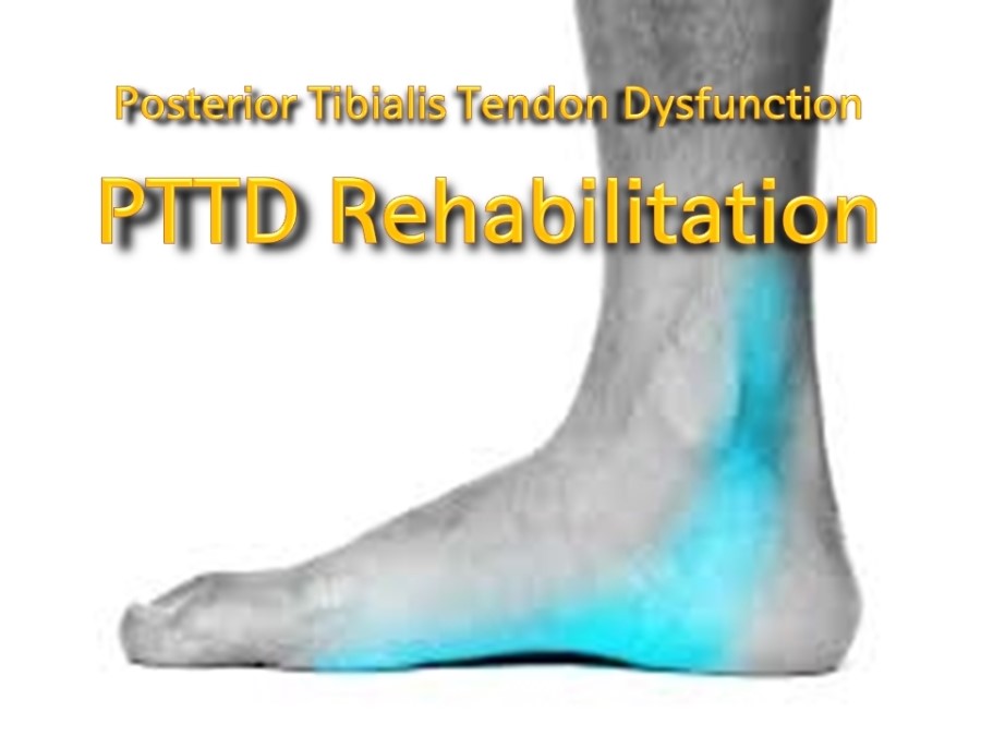 Posterior Tibialis Tendon Dysfunction(PTTD) Rehabilitation - 후경골근 기능부전 ...