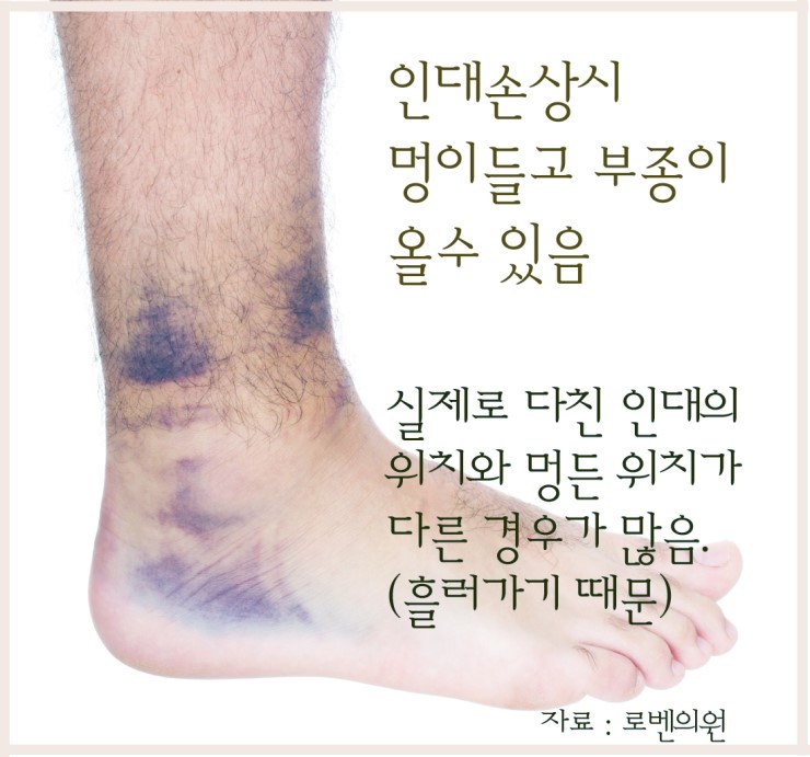 My Image 32