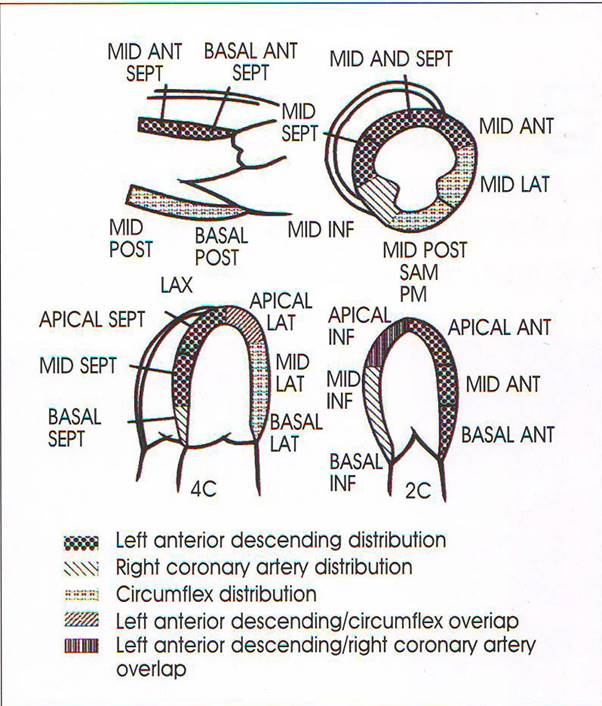 3 009 03 Regional Wall Motion Abnormality RWMA 