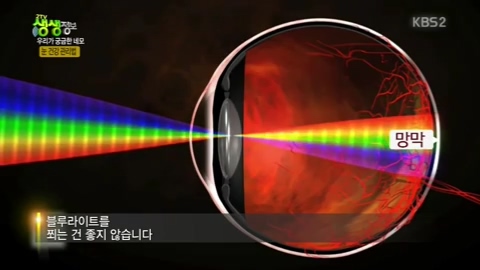 생생정보 - 눈질환 자가진단 - 황반변성, 녹내장, 백내장 - 블로그