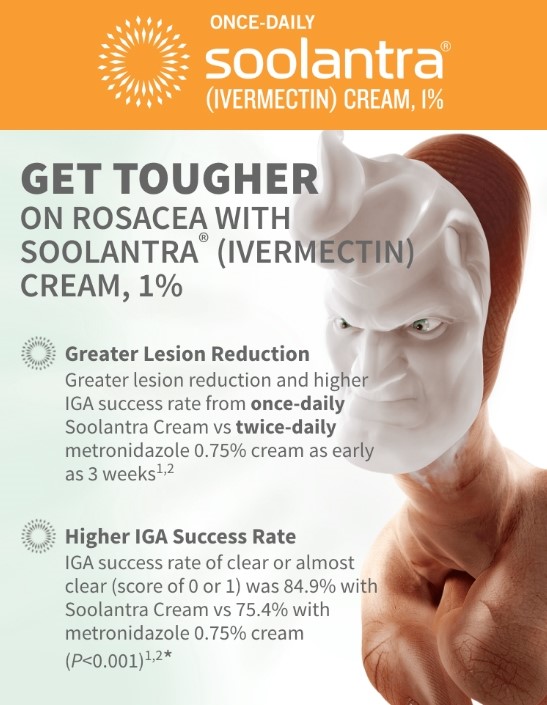 Rosacea: Diagnosis and Treatment - - American Family Physician
