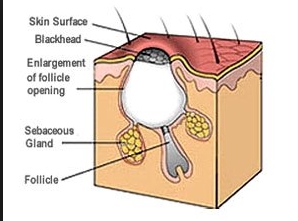 %EC%BD%94%EB%AA%A8%EA%B3%B53.jpg