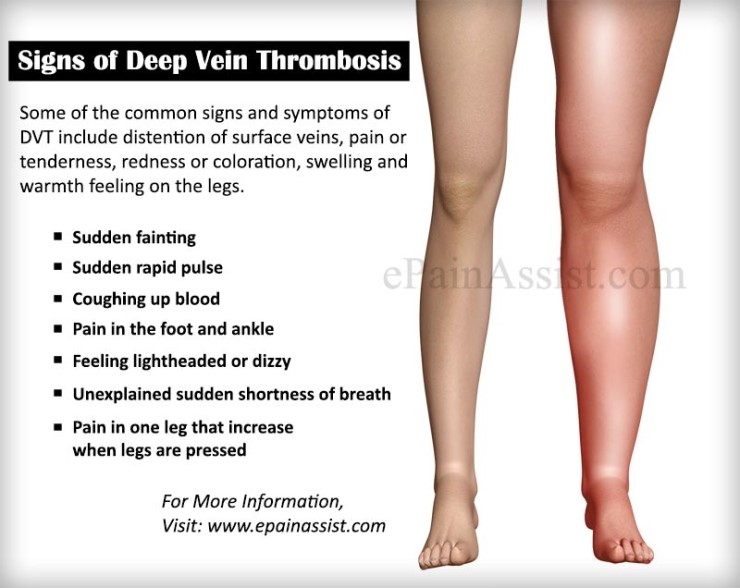 dvt-dvt-disambiguation-japaneseclass-jp