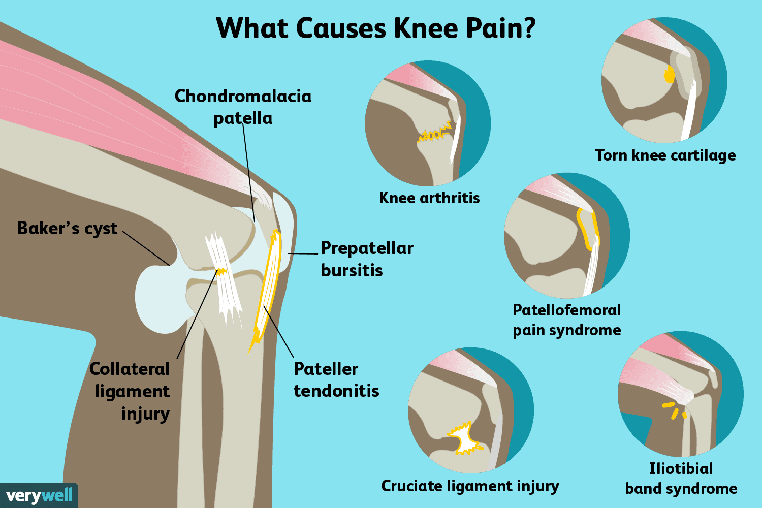 kneepainmedreview-01-5c7d9f26c9e77c0001fd5a7d.png
