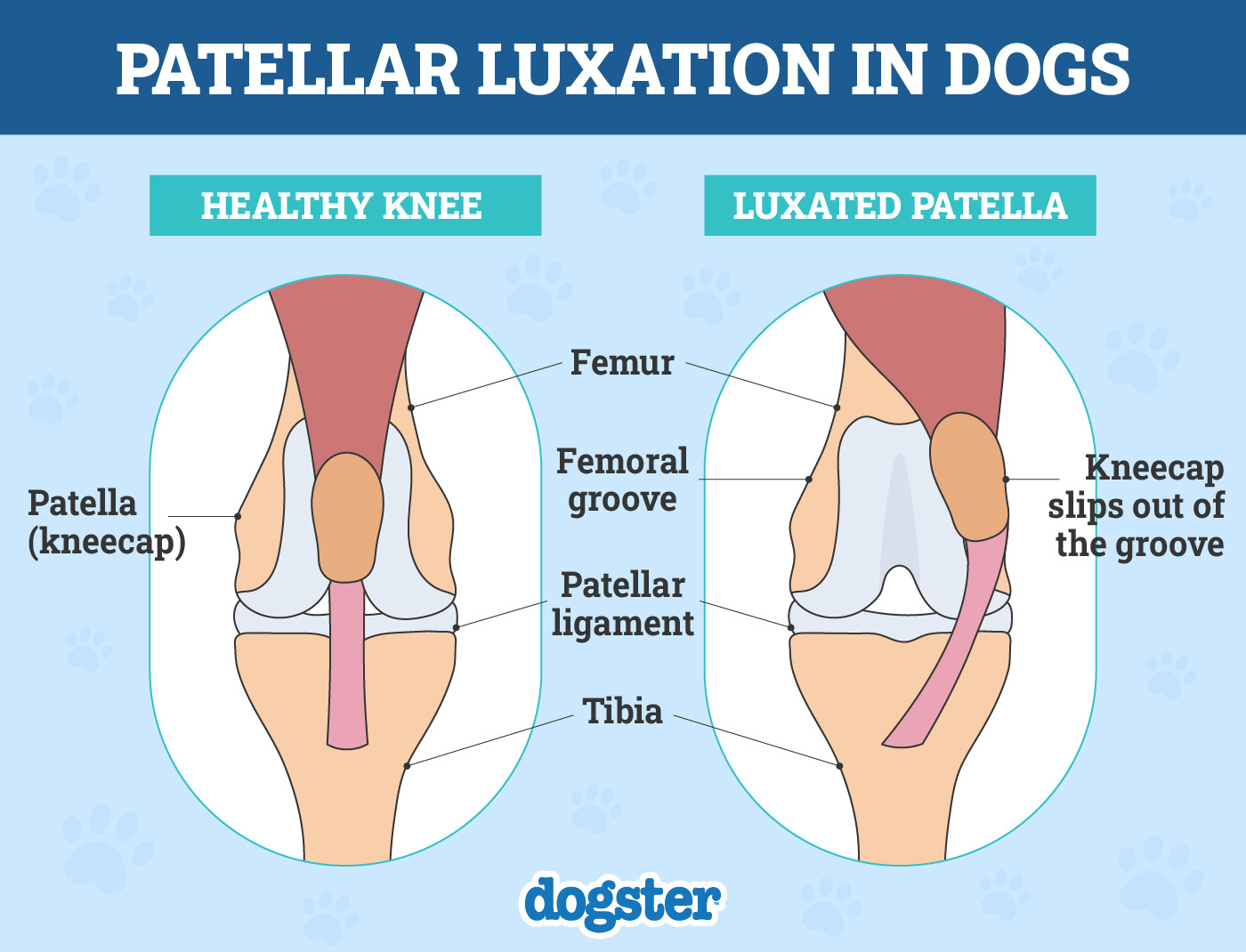 Dogster_Patellar-Luxation-in-Dogs-Infogr