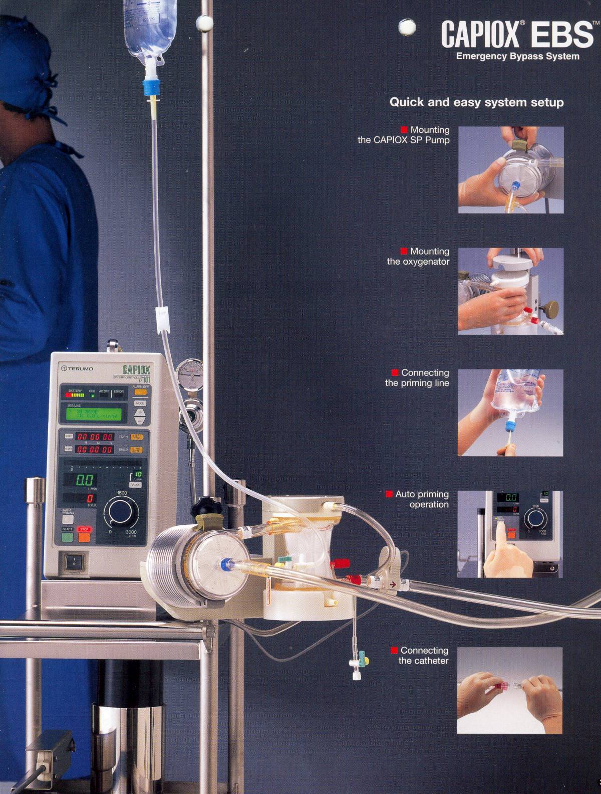 Emergency Bypass System (Terumo) 네이버 블로그