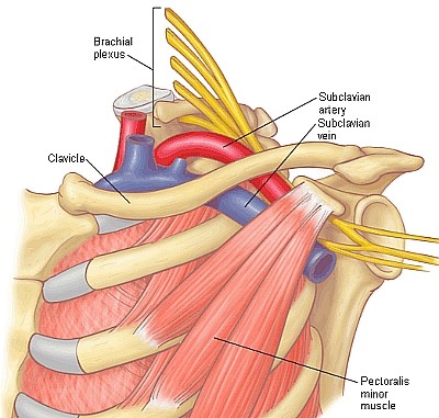 Tos Minor Incision TOS thoracic outlet syndrome 흉곽출구증후군! : 네이버 블로그